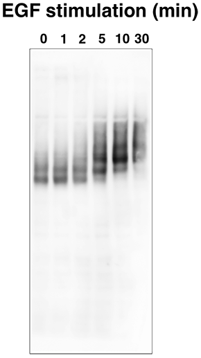 EGFR
